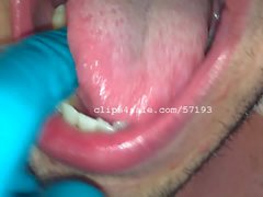 Dental Fetish - Edward Teeth Part4 Video2